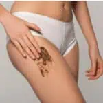 как да се преборим с целулита