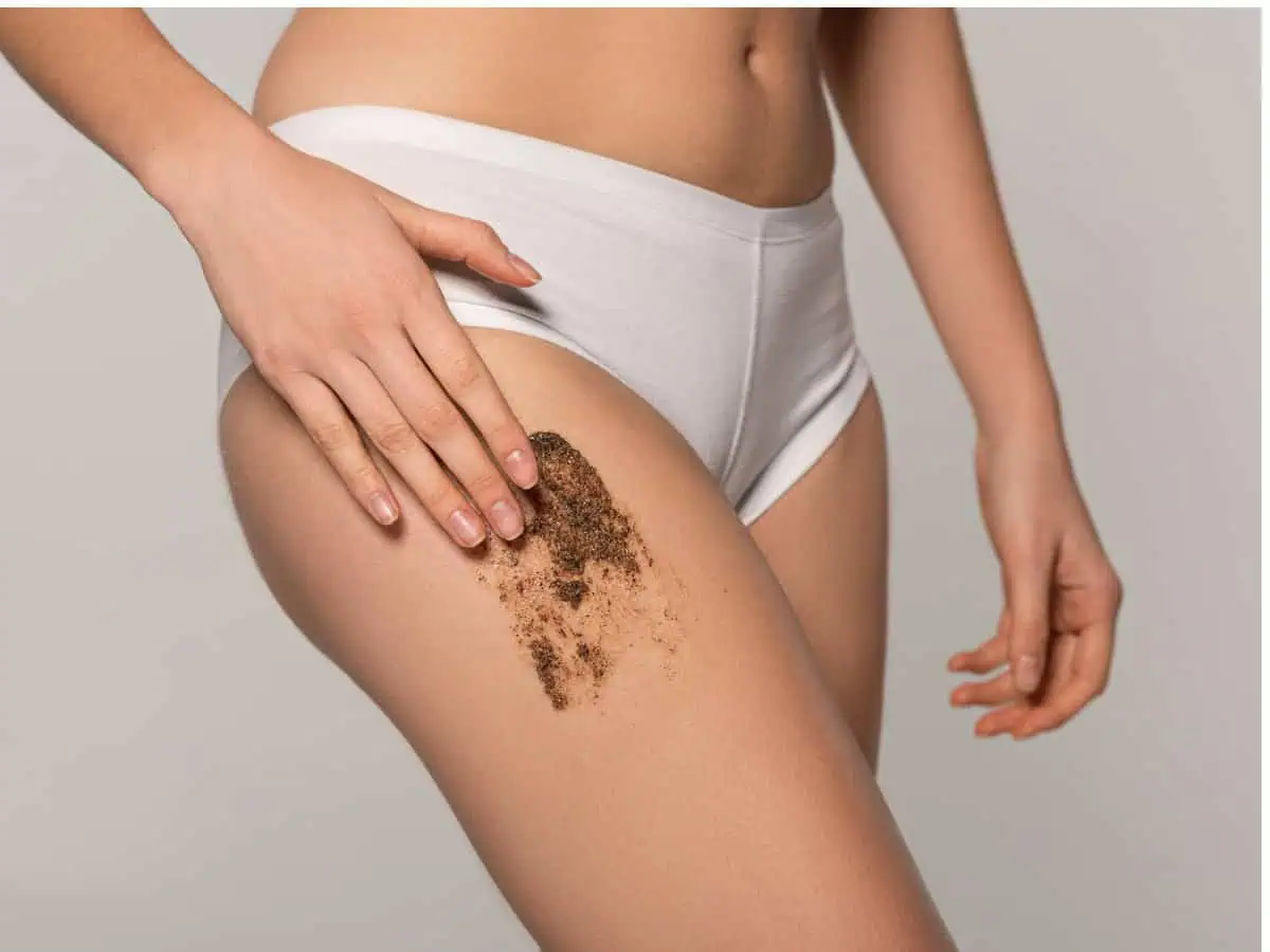 как да се преборим с целулита