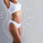 отстраняване на целулит